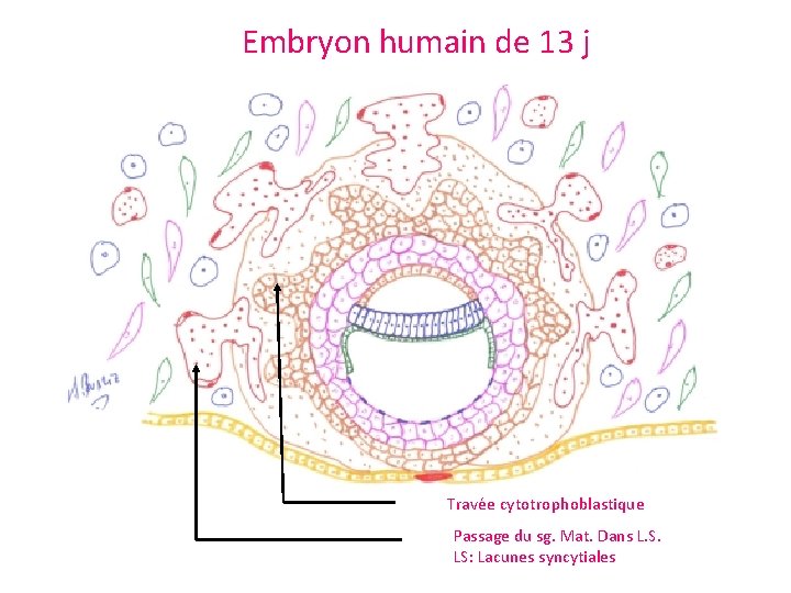 Embryon humain de 13 j Travée cytotrophoblastique Passage du sg. Mat. Dans L. S.