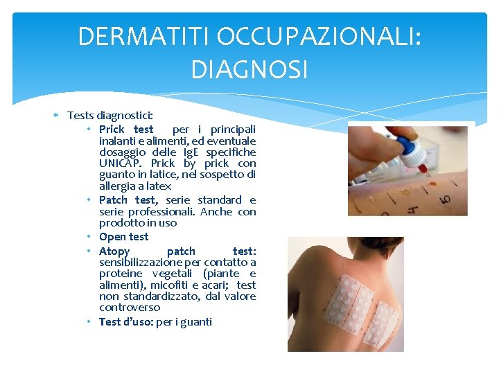 DERMATITI OCCUPAZIONALI: DIAGNOSI Tests diagnostici: • Prick test per i principali inalanti e alimenti,