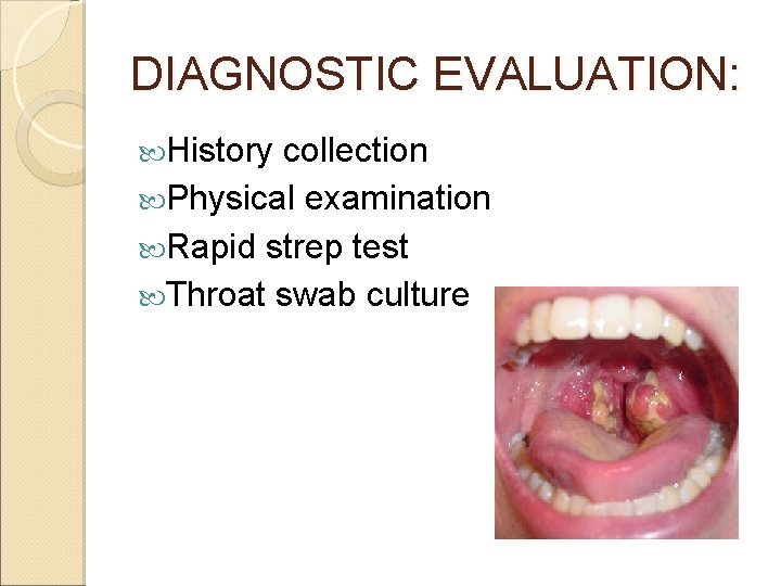 DIAGNOSTIC EVALUATION: History collection Physical examination Rapid strep test Throat swab culture 