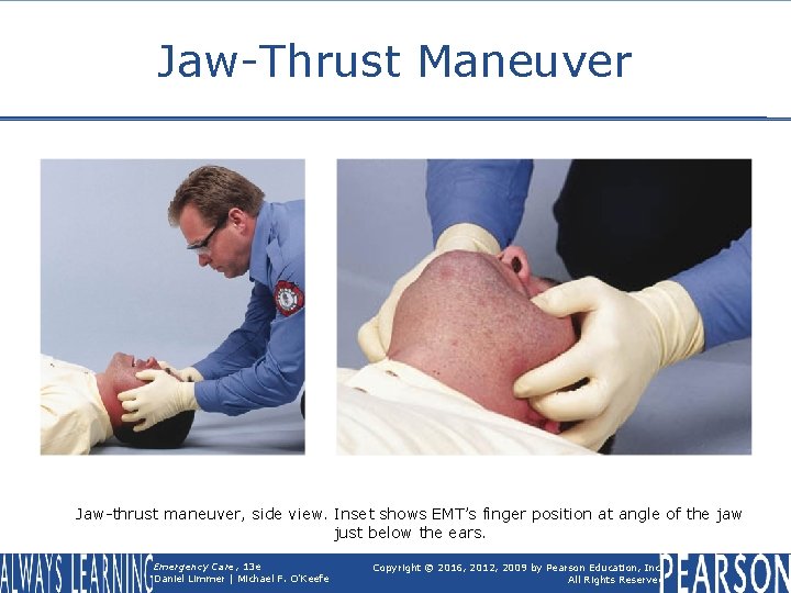 Jaw-Thrust Maneuver Jaw-thrust maneuver, side view. Inset shows EMT’s finger position at angle of