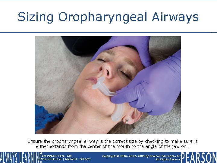 Sizing Oropharyngeal Airways Ensure the oropharyngeal airway is the correct size by checking to
