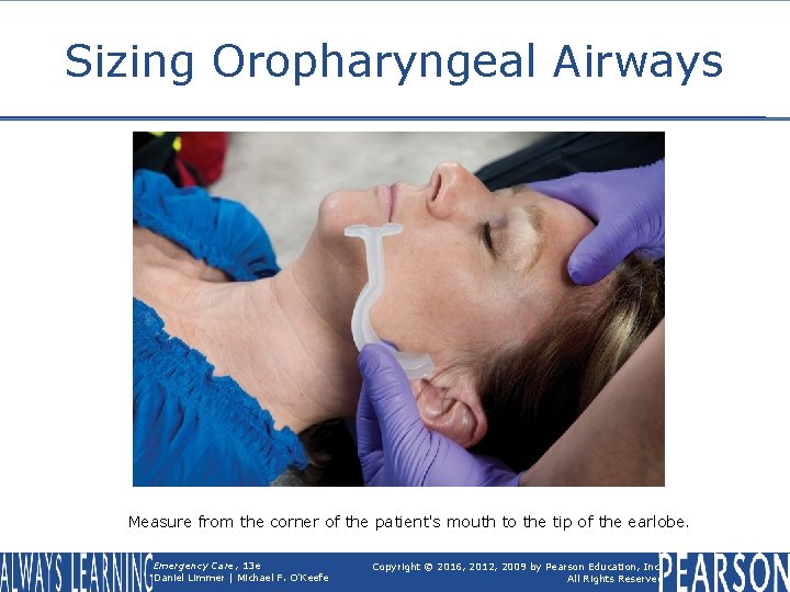 Sizing Oropharyngeal Airways Measure from the corner of the patient's mouth to the tip