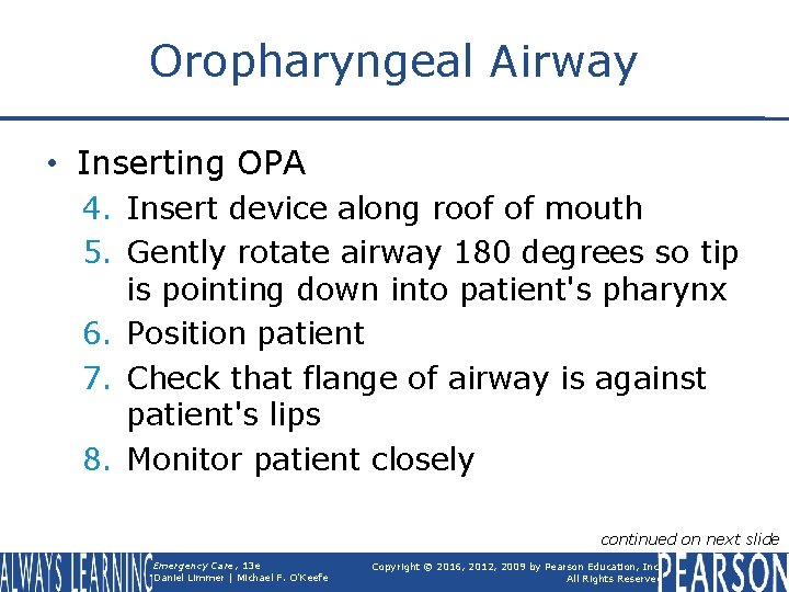 Oropharyngeal Airway • Inserting OPA 4. Insert device along roof of mouth 5. Gently