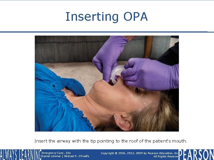 Inserting OPA Insert the airway with the tip pointing to the roof of the