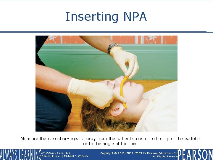 Inserting NPA Measure the nasopharyngeal airway from the patient's nostril to the tip of