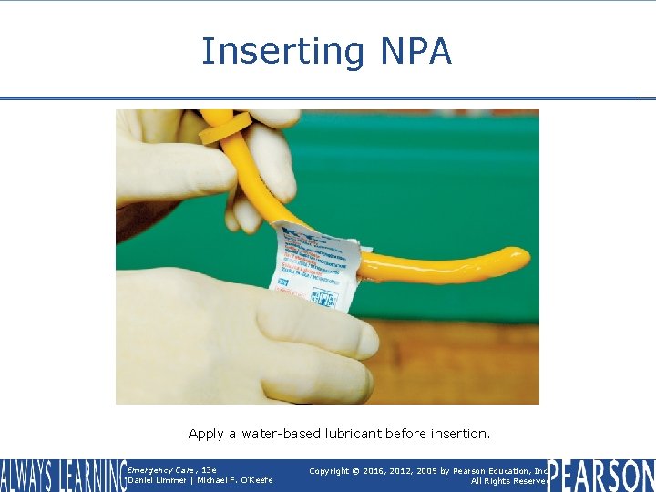 Inserting NPA Apply a water-based lubricant before insertion. Emergency Care, 13 e Daniel Limmer