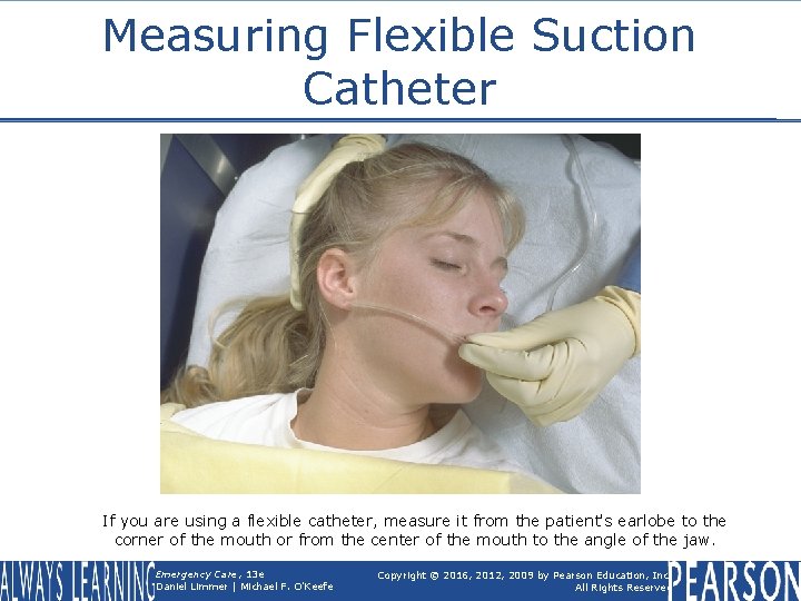Measuring Flexible Suction Catheter If you are using a flexible catheter, measure it from