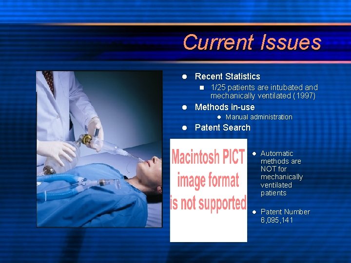 Current Issues l Recent Statistics n l 1/25 patients are intubated and mechanically ventilated