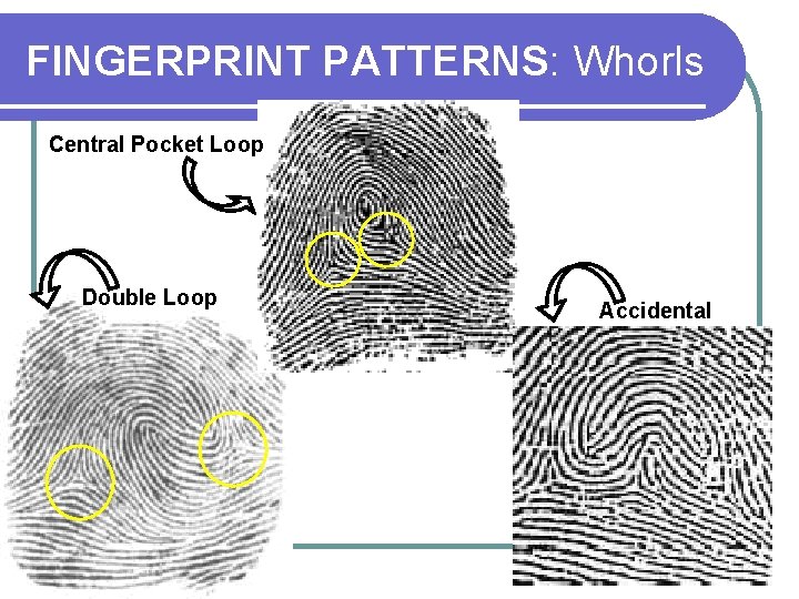 FINGERPRINT PATTERNS: Whorls Central Pocket Loop Double Loop Accidental 