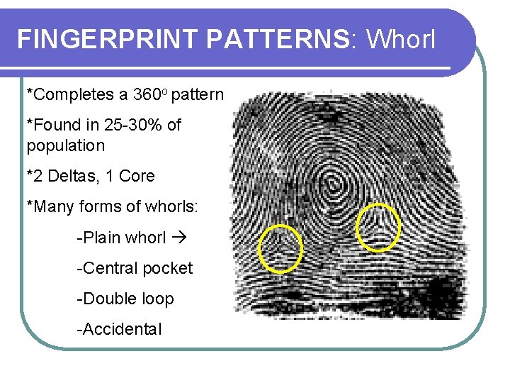 FINGERPRINT PATTERNS: Whorl *Completes a 360 o pattern *Found in 25 -30% of population