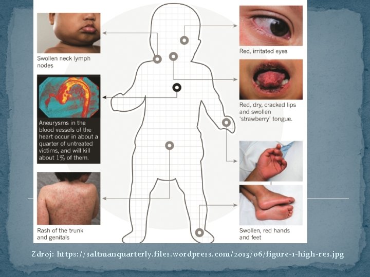 Zdroj: https: //saltmanquarterly. files. wordpress. com/2013/06/figure-1 -high-res. jpg 