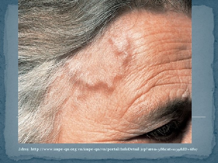 Zdroj: http: //www. impe-qn. org. vn/impe-qn/vn/portal/Info. Detail. jsp? area=58&cat=1139&ID=6817 