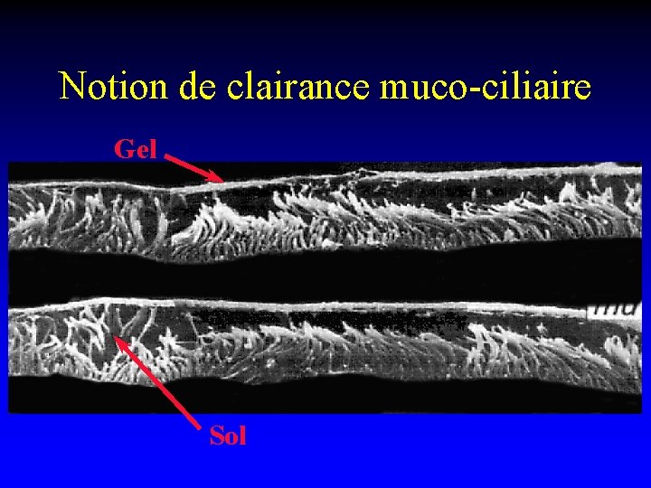 Notion de clairance muco-ciliaire Gel Sol 