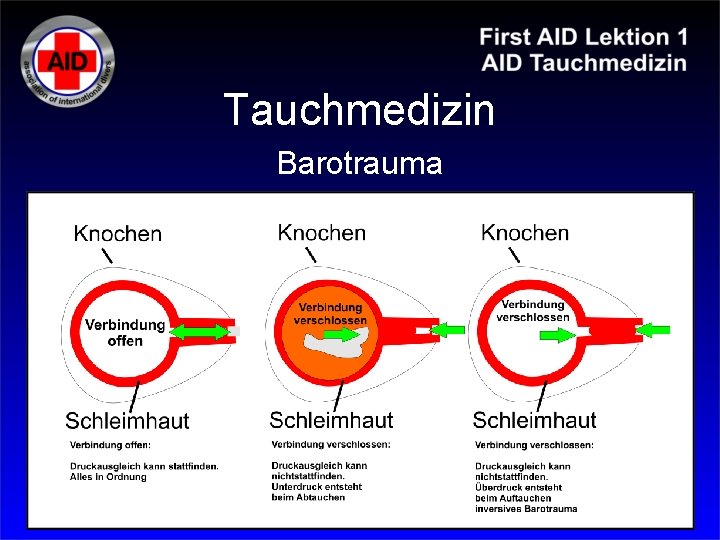 Tauchmedizin Barotrauma 