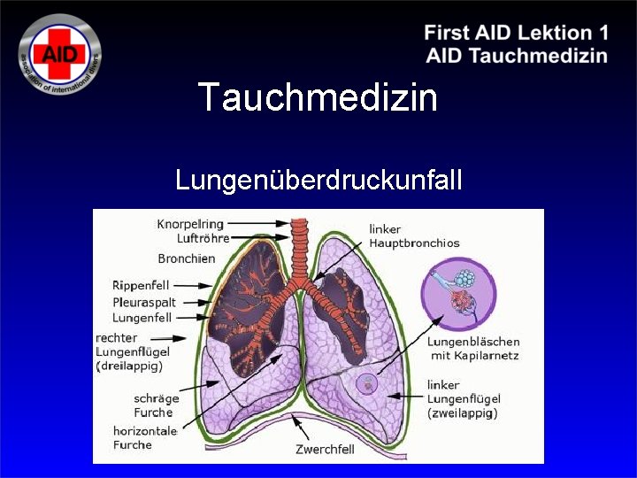 Tauchmedizin Lungenüberdruckunfall 