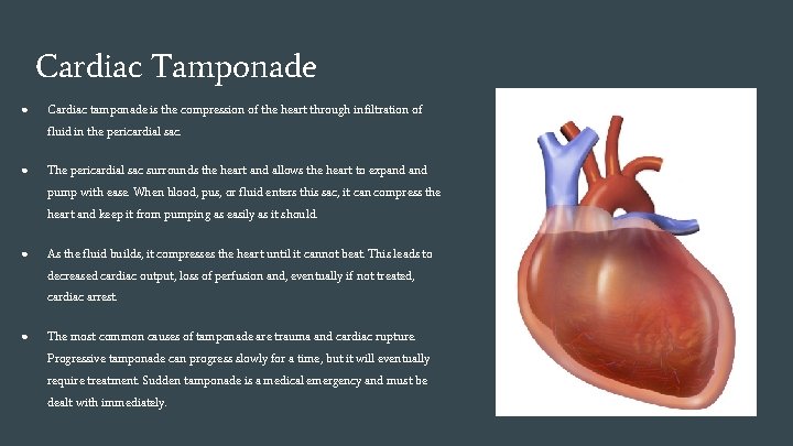 Cardiac Tamponade ● Cardiac tamponade is the compression of the heart through infiltration of