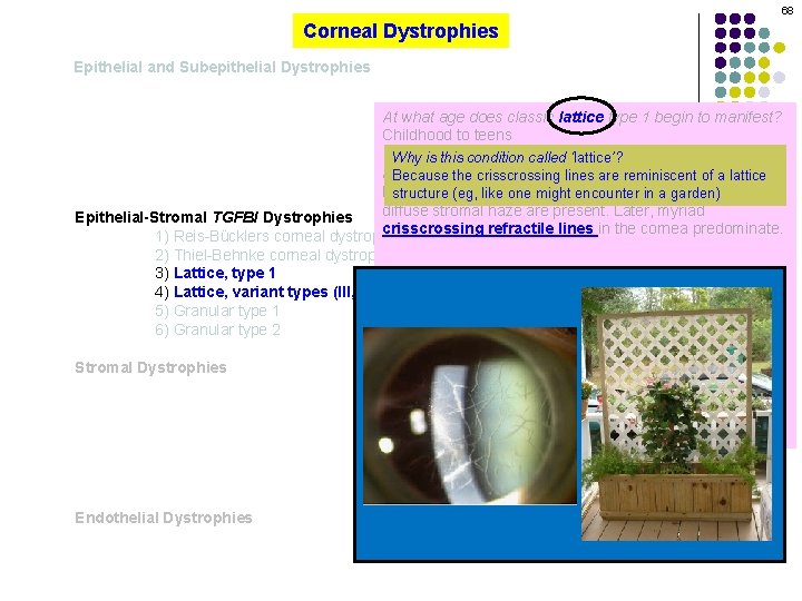 68 Corneal Dystrophies Epithelial and Subepithelial Dystrophies At what age does classic lattice type