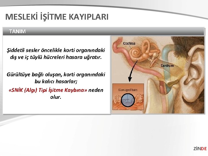 MESLEKİ İŞİTME KAYIPLARI TANIM Şiddetli sesler öncelikle korti organındaki dış ve iç tüylü hücreleri