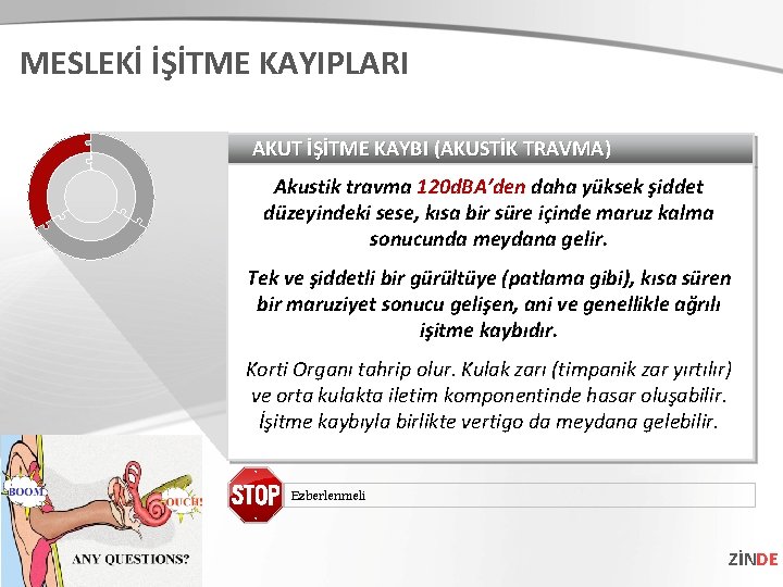 MESLEKİ İŞİTME KAYIPLARI AKUT İŞİTME KAYBI (AKUSTİK TRAVMA) Akustik travma 120 d. BA’den daha