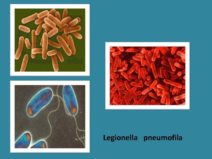 Legionella pneumofila 