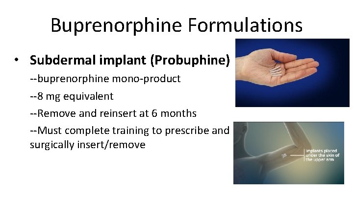 Buprenorphine Formulations • Subdermal implant (Probuphine) --buprenorphine mono-product --8 mg equivalent --Remove and reinsert
