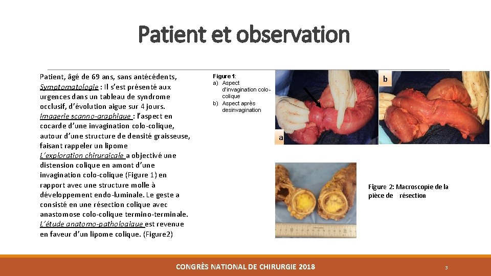 Patient et observation Patient, âgé de 69 ans, sans antécédents, Symptomatologie : Il s’est