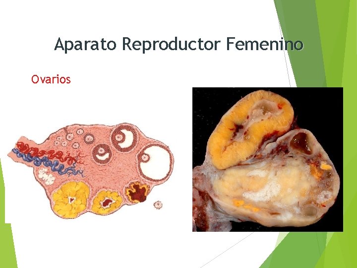 Aparato Reproductor Femenino Ovarios 