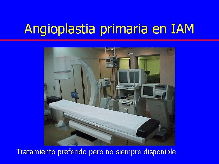 Angioplastia primaria en IAM Tratamiento preferido pero no siempre disponible 