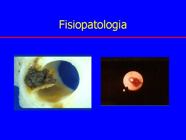 Fisiopatologia 