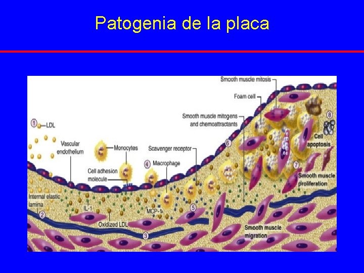 Patogenia de la placa 