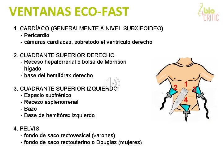 VENTANAS ECO-FAST 1. CARDÍACO (GENERALMENTE A NIVEL SUBXIFOIDEO) - Pericardio - cámaras cardíacas, sobretodo