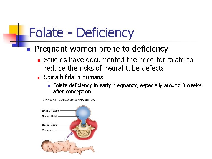 Folate - Deficiency n Pregnant women prone to deficiency n n Studies have documented