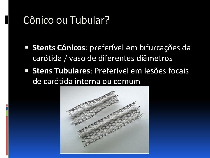 Cônico ou Tubular? Stents Cônicos: preferível em bifurcações da carótida / vaso de diferentes