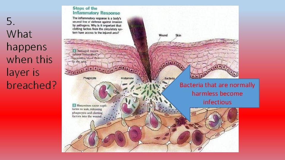 5. What happens when this layer is breached? Bacteria that are normally harmless become