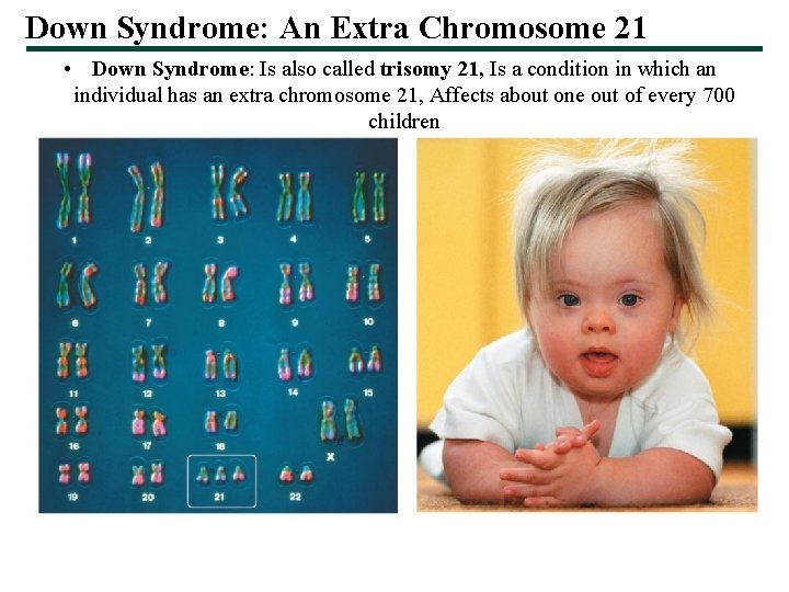 Down Syndrome: An Extra Chromosome 21 • Down Syndrome: Is also called trisomy 21,