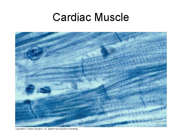 Cardiac Muscle 