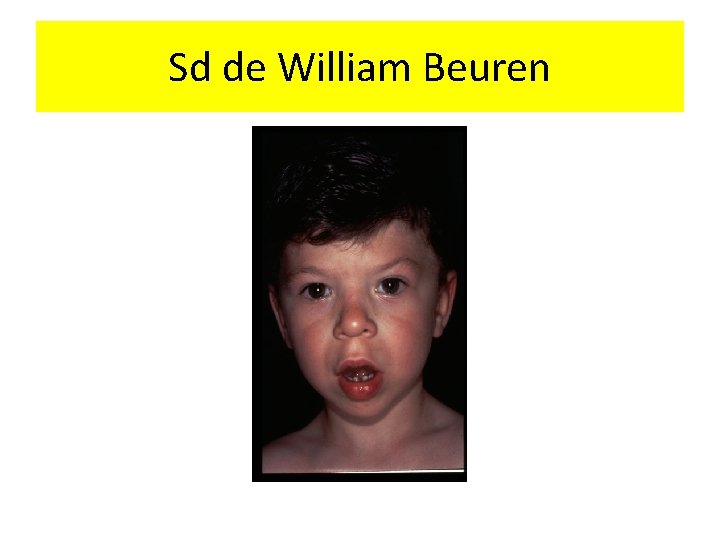 Sd de William Beuren 