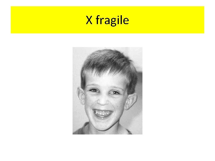 X fragile 