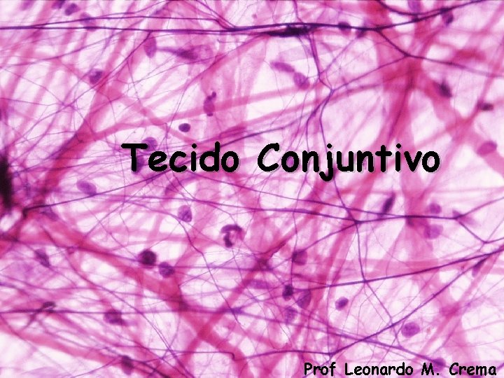 Tecido Conjuntivo Prof Leonardo M. Crema 