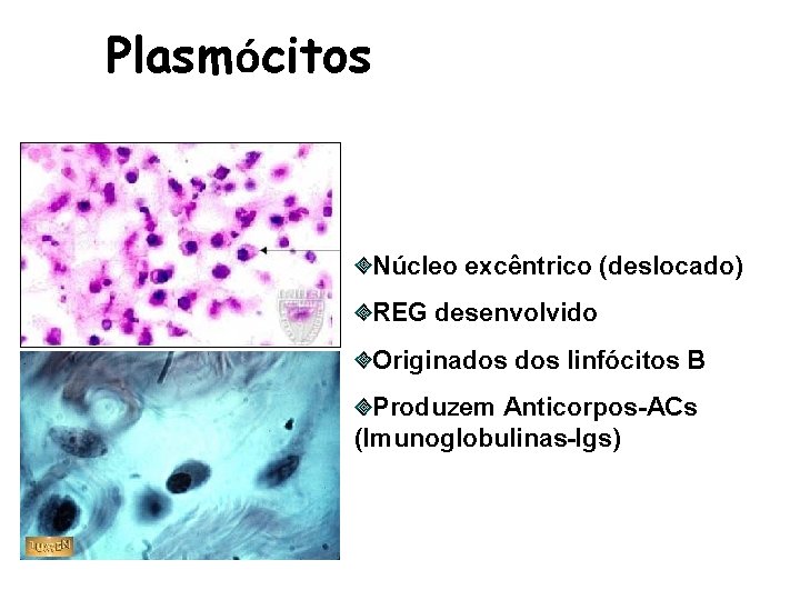 Plasmócitos Núcleo excêntrico (deslocado) REG desenvolvido Originados linfócitos B Produzem Anticorpos-ACs (Imunoglobulinas-Igs) 