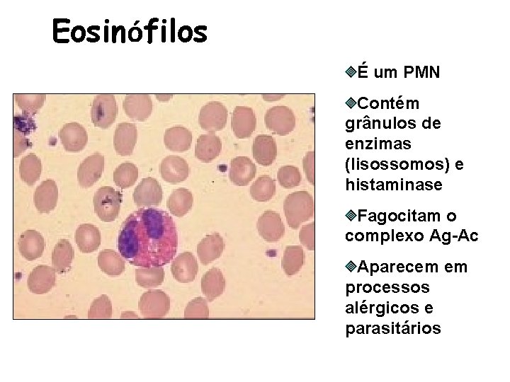 Eosinófilos É um PMN Contém grânulos de enzimas (lisossomos) e histaminase Fagocitam o complexo