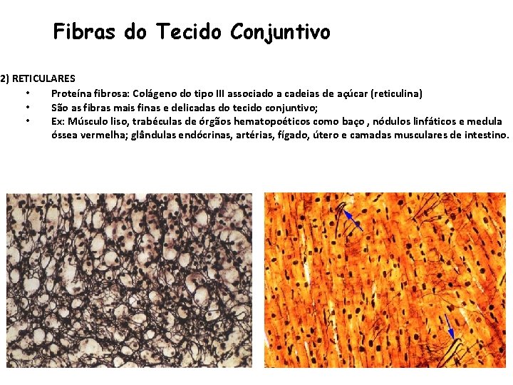 Fibras do Tecido Conjuntivo 2) RETICULARES • Proteína fibrosa: Colágeno do tipo III associado