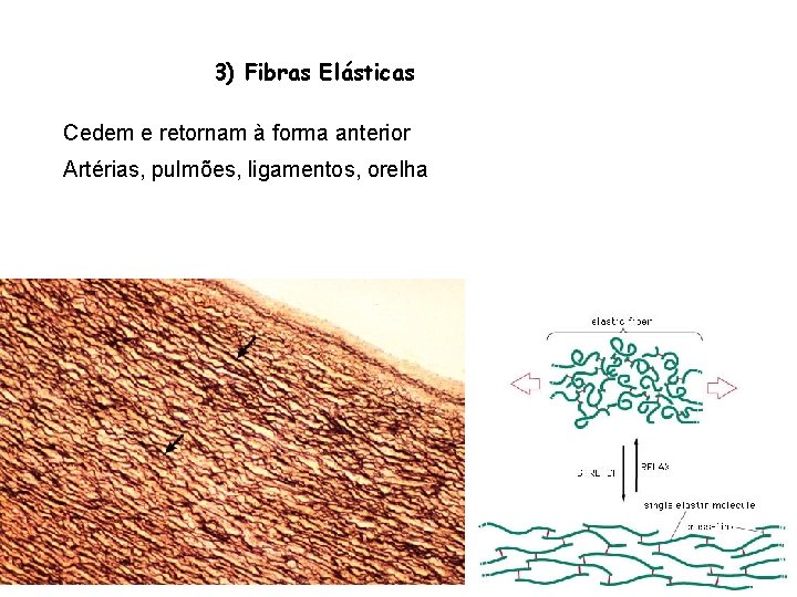 3) Fibras Elásticas Cedem e retornam à forma anterior Artérias, pulmões, ligamentos, orelha 