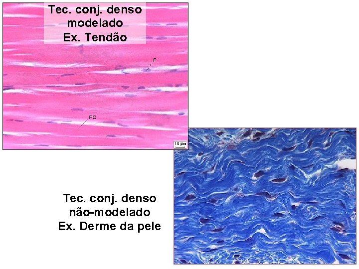 Tec. conj. denso modelado Ex. Tendão Tec. conj. denso não-modelado Ex. Derme da pele