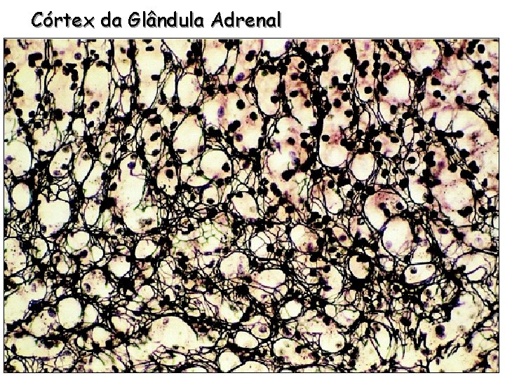 Córtex da Glândula Adrenal 