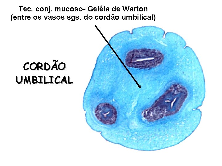 Tec. conj. mucoso- Geléia de Warton (entre os vasos sgs. do cordão umbilical) CORDÃO