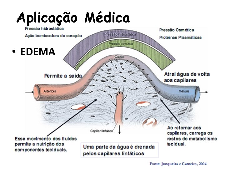 Aplicação Médica • EDEMA 