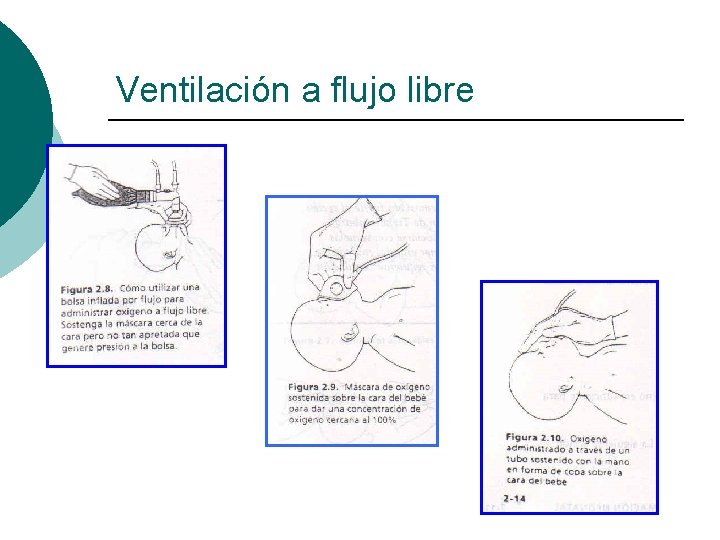 Ventilación a flujo libre 