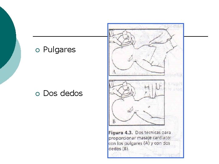 ¡ Pulgares ¡ Dos dedos 