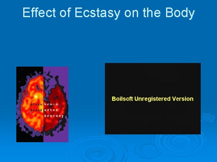 Effect of Ecstasy on the Body 